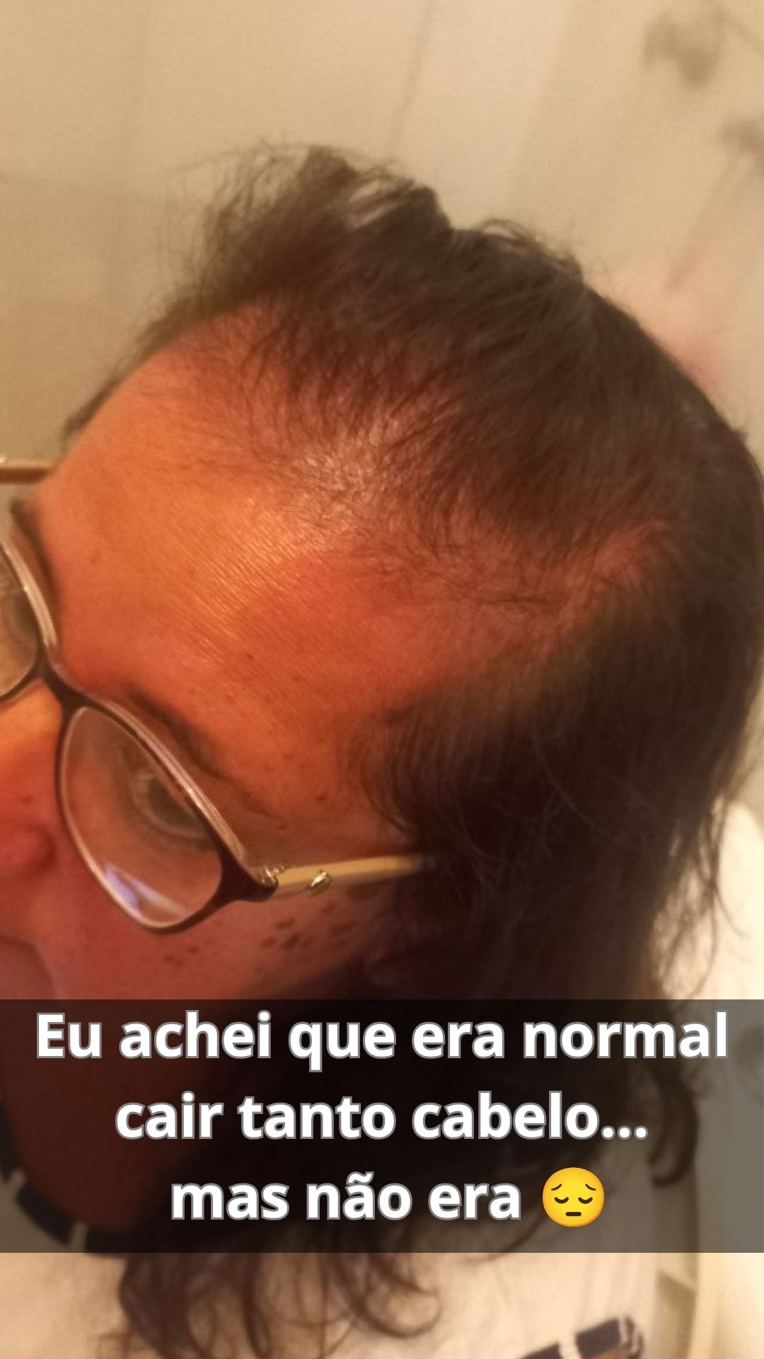 Evolução Inicial Silmara